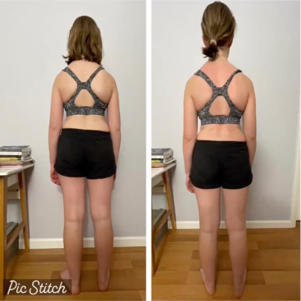 Pelvic Leveling & Spine Ease — Before and After